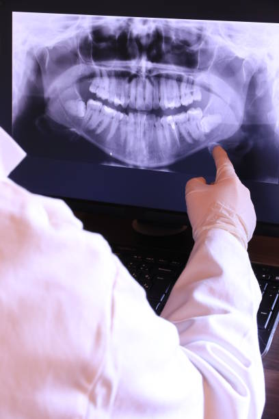 Best Emergency Tooth Extraction in Holbrook, AZ